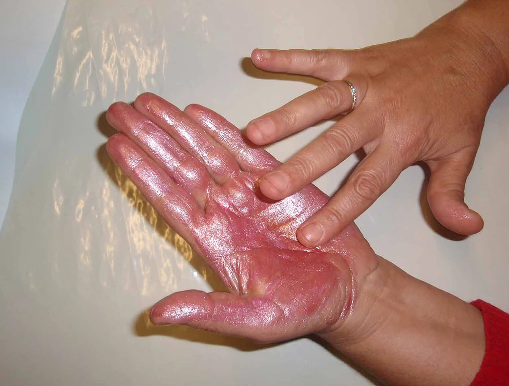 Zila - Consulta por corresnpodência