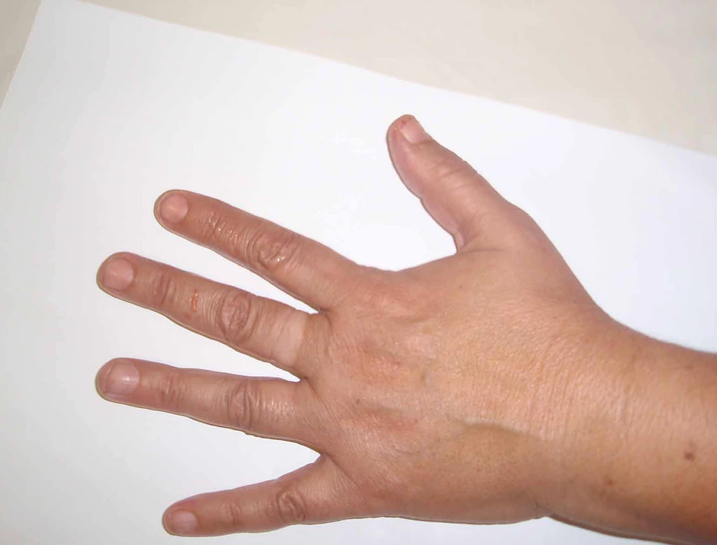 Zila - Consulta por corresnpodência