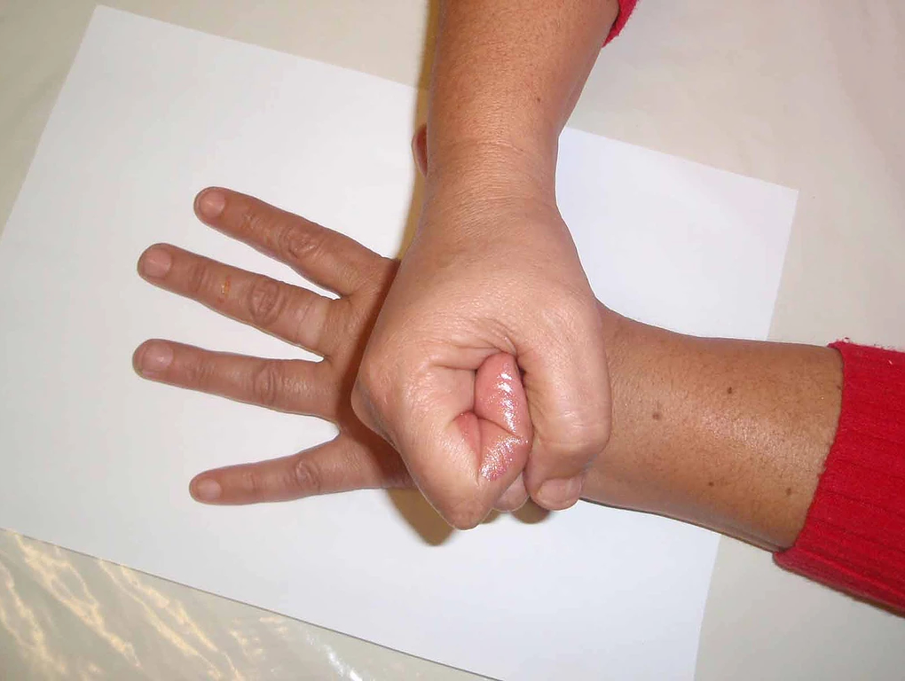 Zila - Consulta por corresnpodência